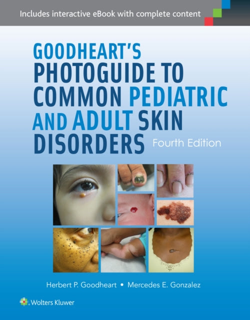Book cover of: Goodheart's Photoguide to Common Pediatric and Adult Skin Disorders. By: Herbert P. Goodheart