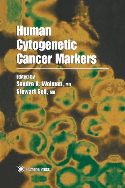 Book cover of: Human Cytogenetic Cancer Markers. By: Sandra R. Wolman