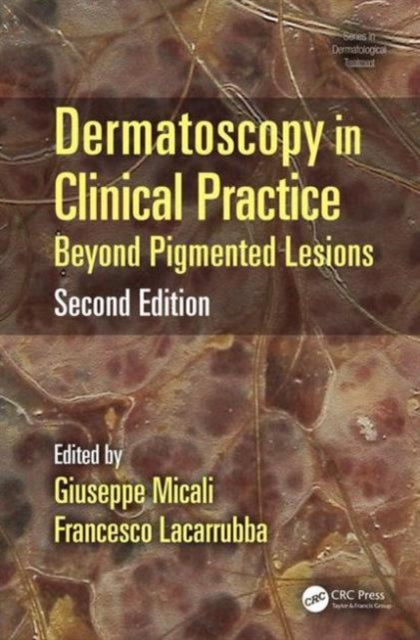 Book cover of: Dermatoscopy in Clinical Practice. By: Giuseppe Micali