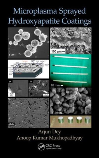 Book cover of: Microplasma Sprayed Hydroxyapatite Coatings. By: Arjun Dey