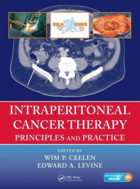 Book cover of: Intraperitoneal Cancer Therapy. By: Wim P. Ceelen