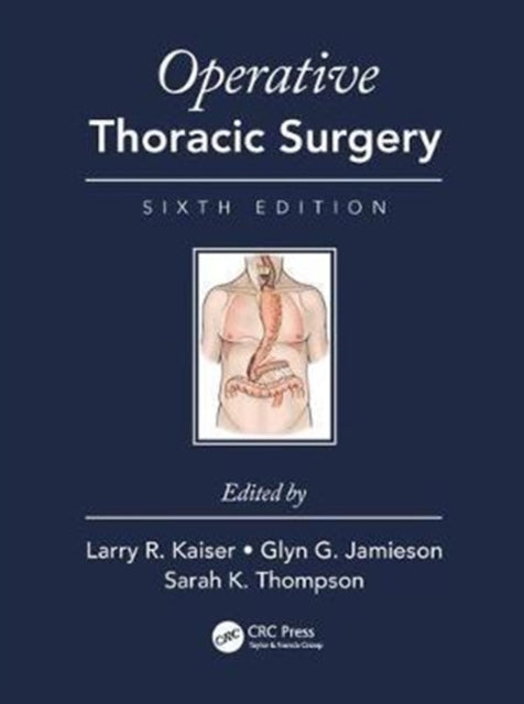 Book cover of: Operative Thoracic Surgery. By: Larry R. Kaiser