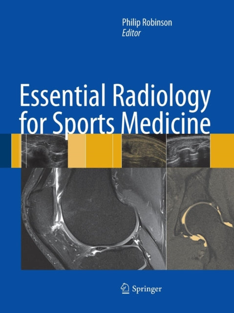 Book cover of: Essential Radiology for Sports Medicine. By: Philip Robinson undifferentiated