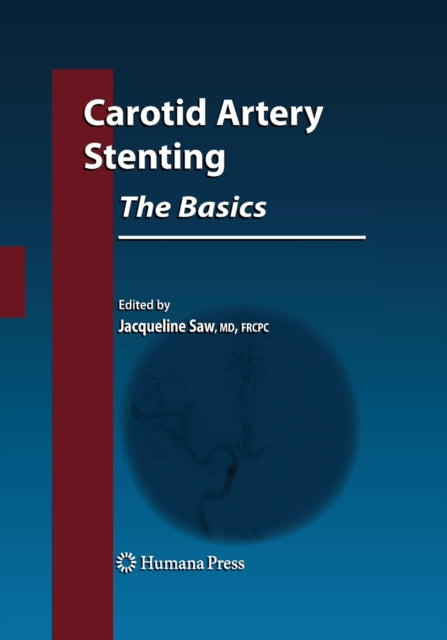 Carotid Artery Stenting: The Basics