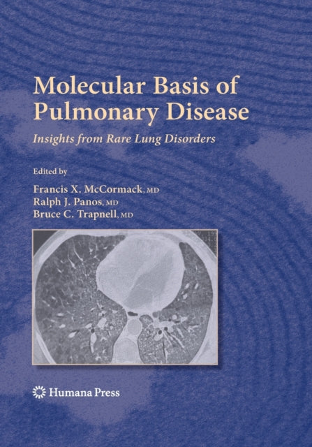 Book cover of: Molecular Basis of Pulmonary Disease. By: Francis X. McCormack