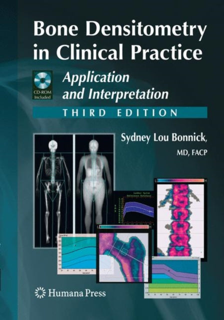 Book cover of: Bone Densitometry in Clinical Practice. By: Sydney Lou Bonnick