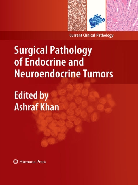 Book cover of: Surgical Pathology of Endocrine and Neuroendocrine Tumors. By: Ashraf Khan