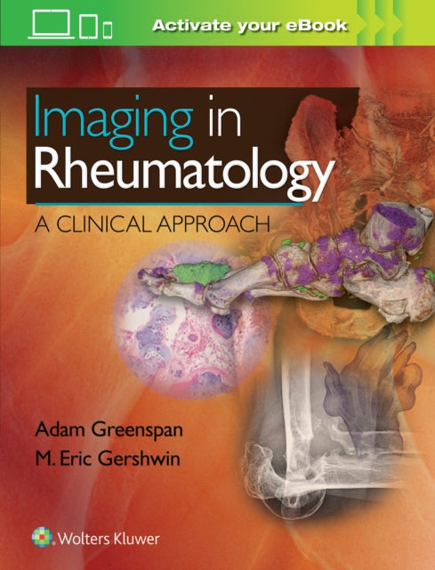 Book cover of: Imaging in Rheumatology. By: Adam Greenspan M.D.  FACR