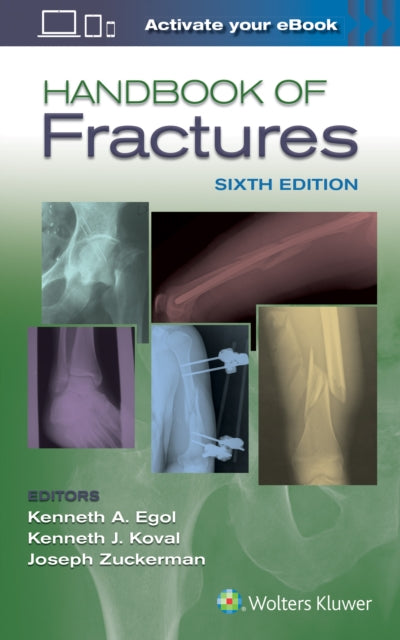 Book cover of: Handbook of Fractures. By: Kenneth Egol MD