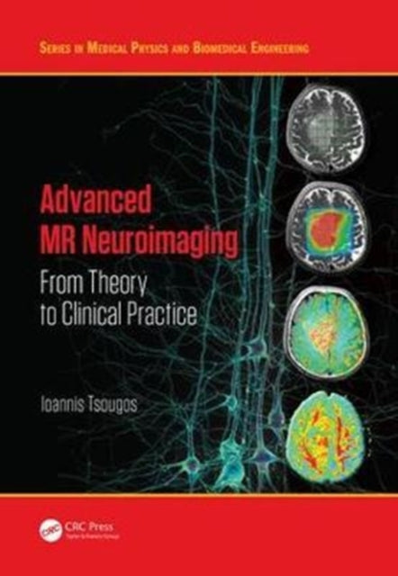 Advanced MR Neuroimaging