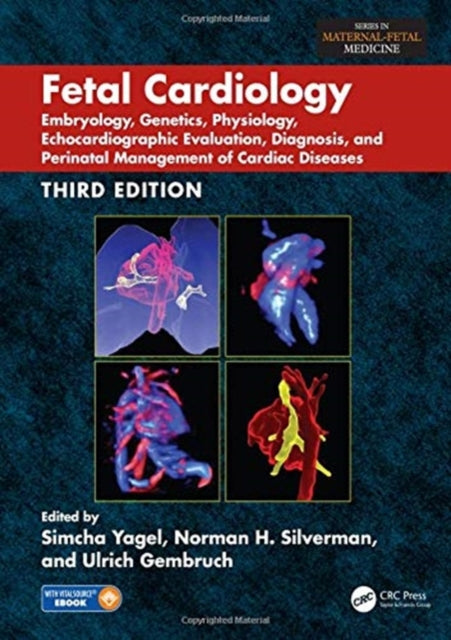 Book cover of: Fetal Cardiology. By: Simcha Yagel