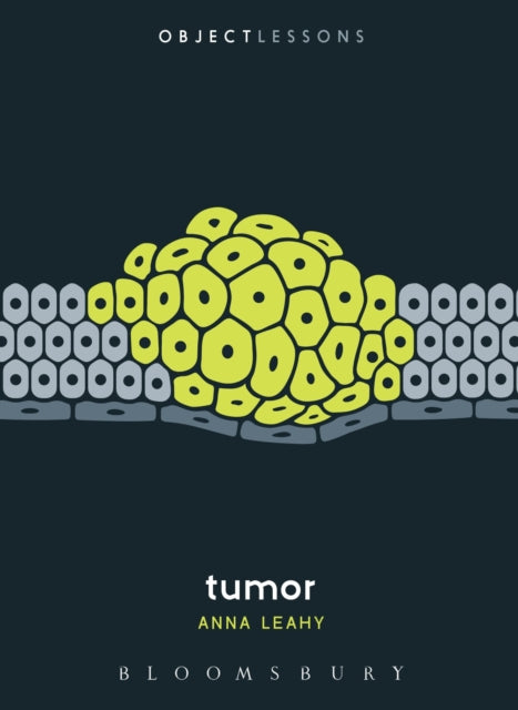 Book cover of: Tumor. By: Anna Leahy