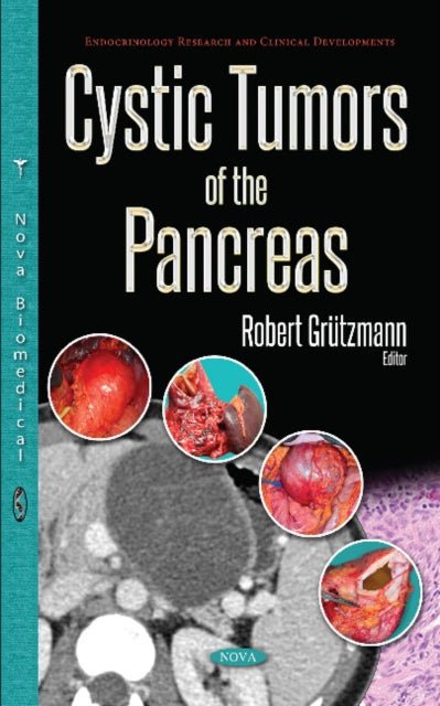 Book cover of: Cystic Tumors of the Pancreas. By: Robert Grützmann