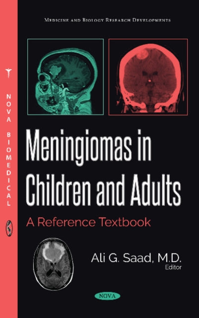 Book cover of: Meningiomas in Children and Adults. By: Ali G. Saad