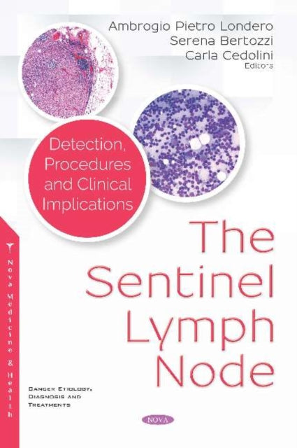 Book cover of: Sentinel Lymph Node. By: Ambrogio Pietro Londero