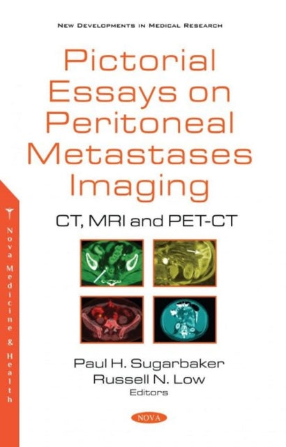 Book cover of: Pictorial Essays on Peritoneal Metastases Imaging. By: Paul H. Sugarbaker