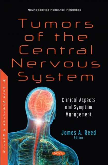 Book cover of: Tumors of the Central Nervous System. By: James A. Reed