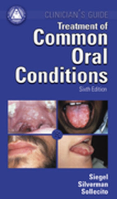 Book cover of: Treatment Common Oral Conditions. By: Michael A. Siegel