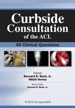 Curbside Consultation of the ACL