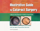 Book cover of: Illustrative Guide to Cataract Surgery. By: Amar Agarwal