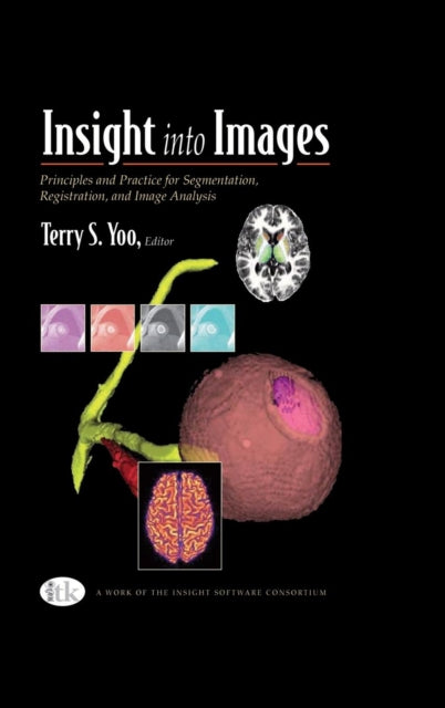 Insight into Images