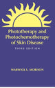 Book cover of: Phototherapy and Photochemotherapy for Skin Disease. By: Warwick L. Morison