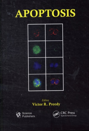 Apoptosis