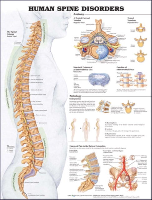 Book cover of: Human Spine Disorders Anatomical Chart. By: Anatomical Chart Company