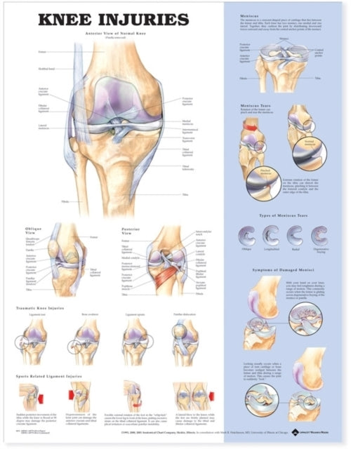 Book cover of: Knee Injuries Anatomical Chart. By: Anatomical Chart Company