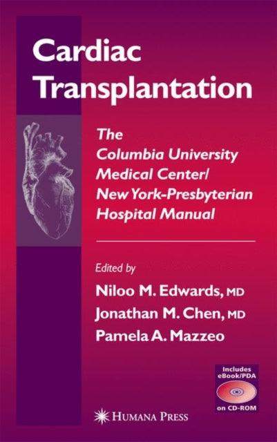 Book cover of: Cardiac Transplantation