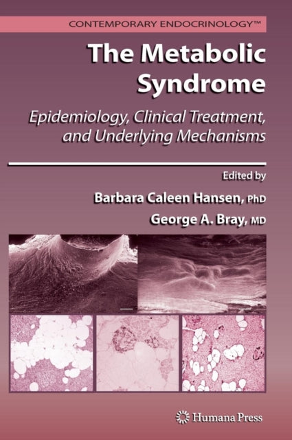 The Metabolic Syndrome: