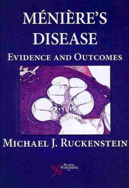 Book cover of: Meniere's Disease. By: Michael J. Ruckenstein, Michael Ruckenstein