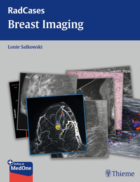 Book cover of: Radcases Breast Imaging. By: Lonie L. Salkowski