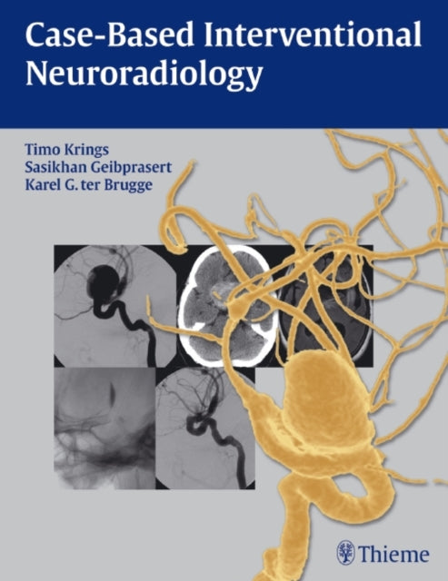 Book cover of: Case-Based Interventional Neuroradiology. By: Timo Krings