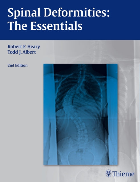 Book cover of: Spinal Deformities. By: Robert F. Heary