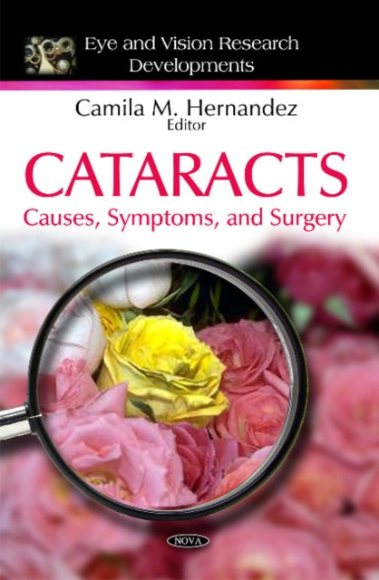 Book cover of: Cataracts. By: Camila M. Hernandez