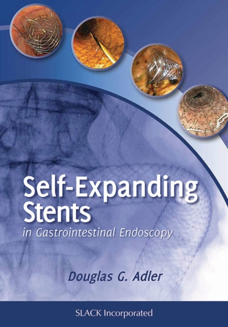 Book cover of: Self-Expanding Stents in Gastrointestinal Endoscopy. By: Douglas G. Adler