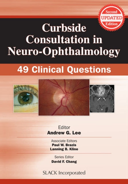 Book cover of: Curbside Consultation in Neuro-Ophthalmology. By: Andrew G. Lee MD