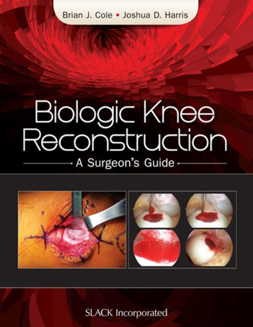 Book cover of: Biologic Knee Reconstruction. By: Dr. Brian Cole MD