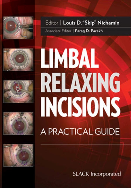 Book cover of: Limbal Relaxing Incisions. By: Louis D. Nichamin