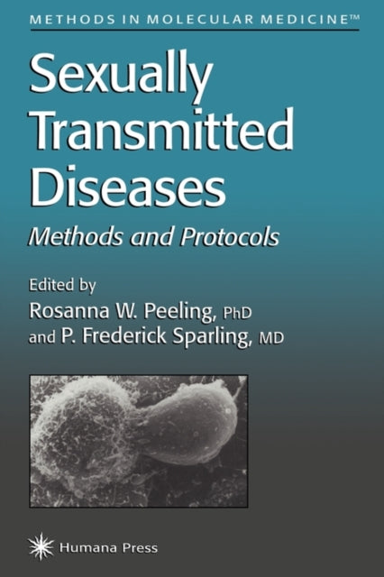 Book cover of: Sexually Transmitted Diseases. By: Rosanna Peeling