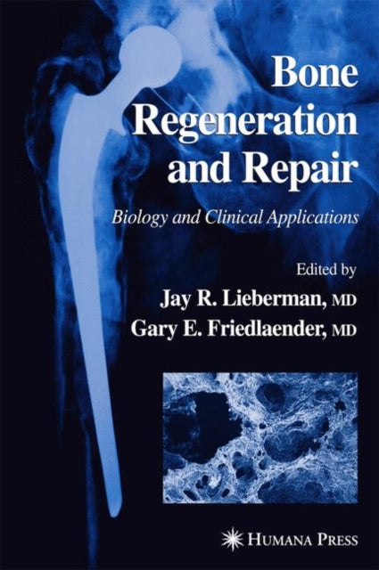 Book cover of: Bone Regeneration and Repair. By: Jay R. Lieberman