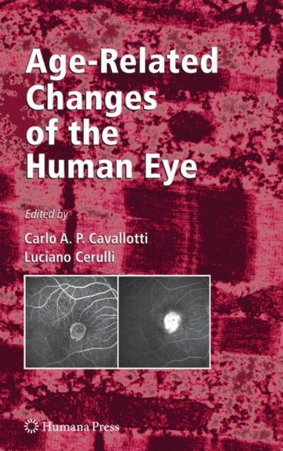 Book cover of: Age-Related Changes of the Human Eye. By: Carlo Cavallotti