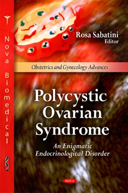 Book cover of: Polycystic Ovarian Syndrome. By: Rosa Sabatini