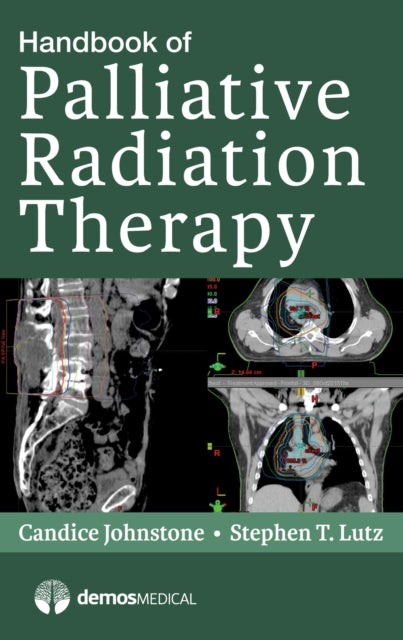 Book cover of: Handbook of Palliative Radiation Therapy. By: Candice Johnstone