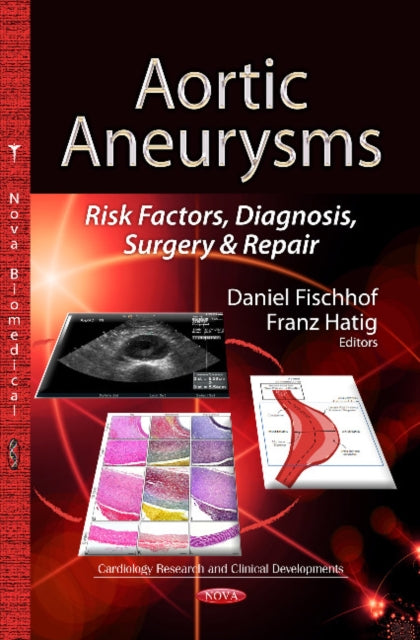Book cover of: Aortic Aneurysms