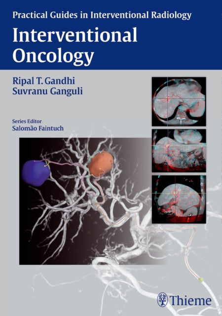 Book cover of: Interventional Oncology. By: Suvranu Ganguli