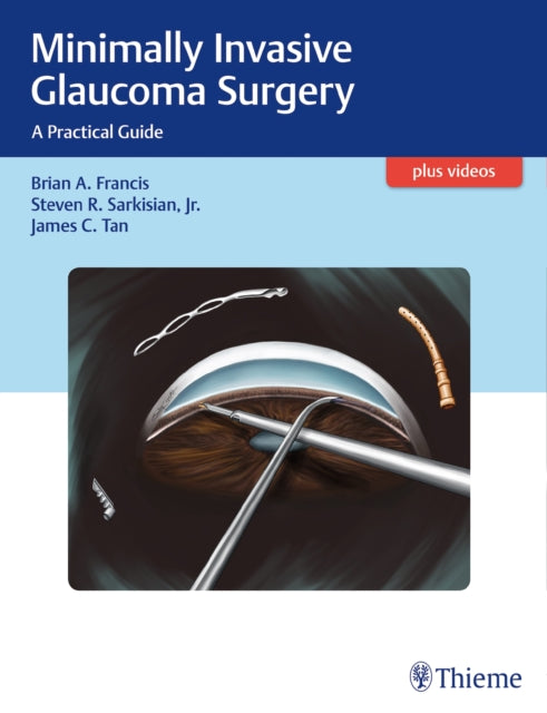Book cover of: Minimally Invasive Glaucoma Surgery