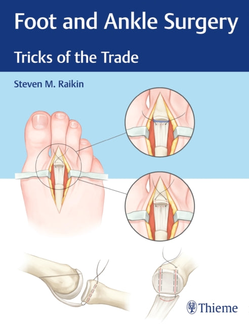 Book cover of: Foot and Ankle Surgery. By: Steven Raikin