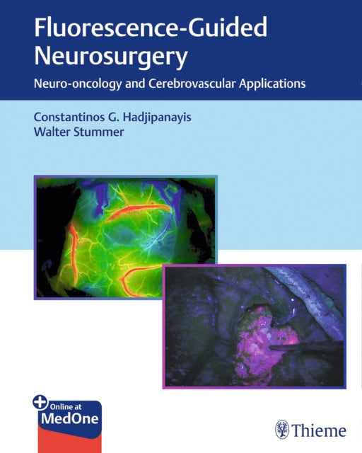 Book cover of: Fluorescence-Guided Neurosurgery. By: Constantinos G. Hadjipanayis